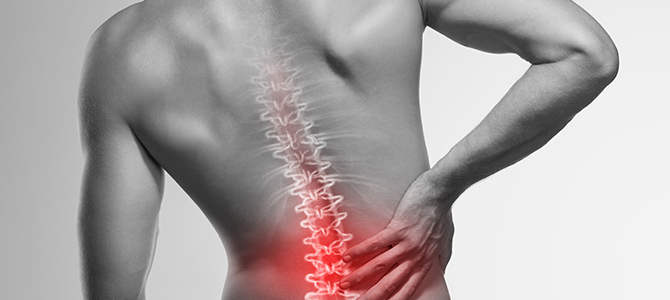 Ankylosing Spondylitis (AS)