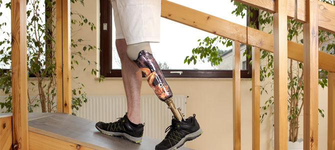 Arthroplasty Rehabilitation