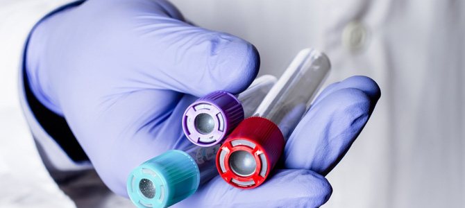 X-Ray, MR, Blood And Urine Test